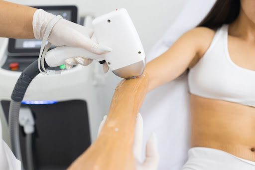 Laser Hair Removal: A Simplified Approach to Beauty