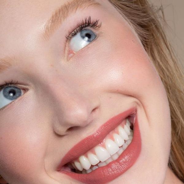 Tooth Bonding Cost Is It Worth the Price?