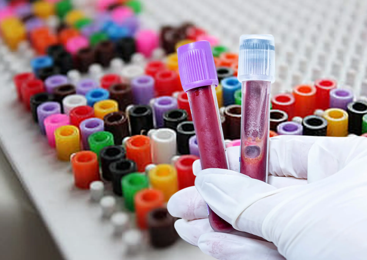 Regulatory Approvals and New Product Launches Drive Blood Collection Tubes Market Forward
