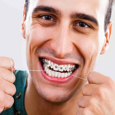 Understanding Orthodontic Emergencies: When to Seek Help