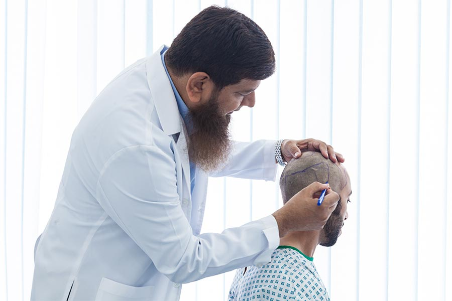 اكتشف أفضل تقنية زراعة الشعر FUE اليوم!