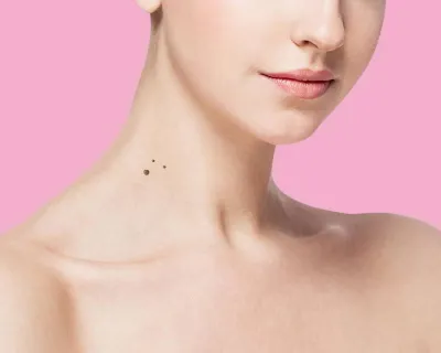 The Ultimate Tan Removal Treatment for Your Skin