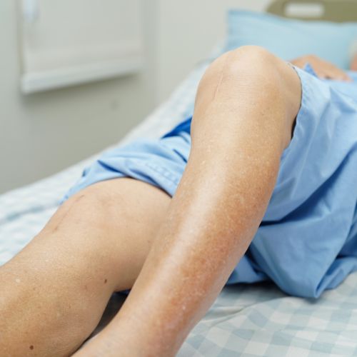 Best Knee Surgeon in London: Expertise and Excellence in Knee Care