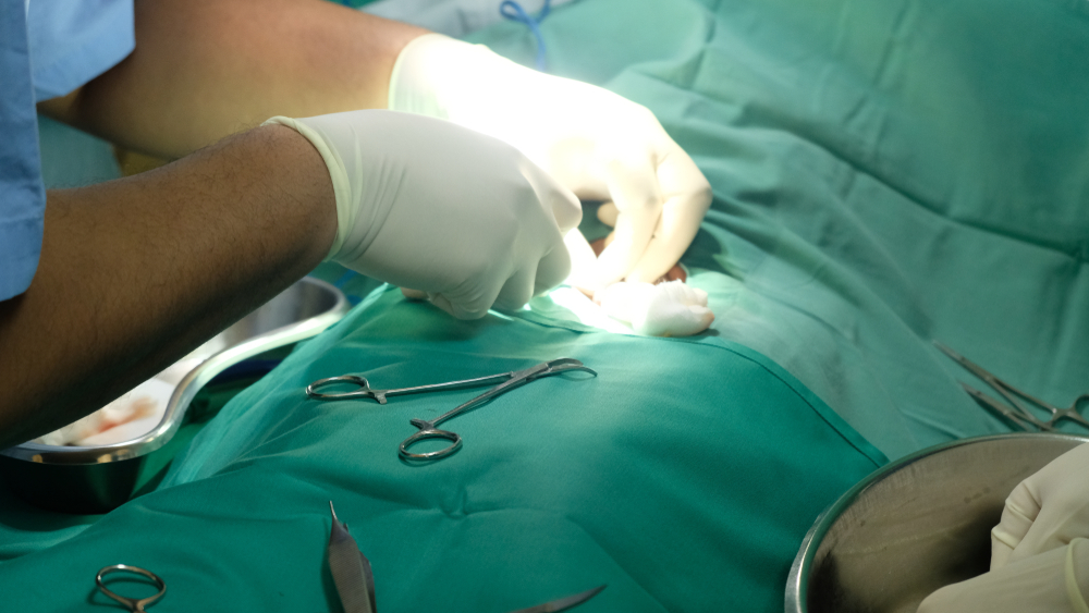 Male Circumcision for Health and Hygiene Medical Perspective