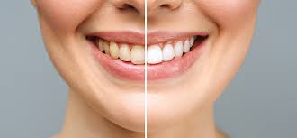 Comprehensive Guide to Finding the Best Cosmetic Dentistry Doctors in Malad West