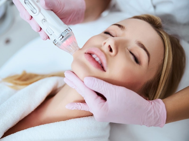 What Makes Fractional RF Microneedling Different from Other Treatments?