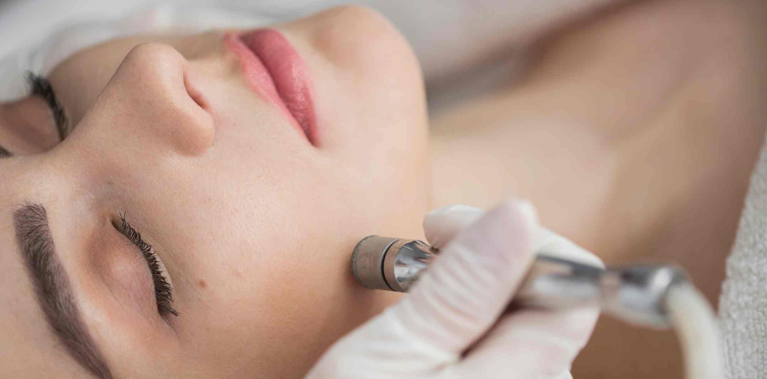 Erase Dead Skin Cells and Reveal Radiance with Diamond Peel