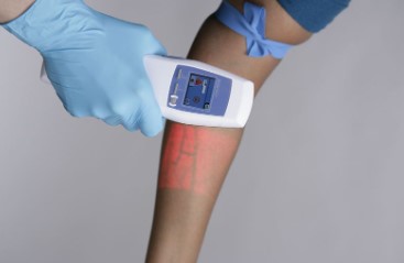 Vein Illumination Devices Market Size Share & Forecast Report, 2024