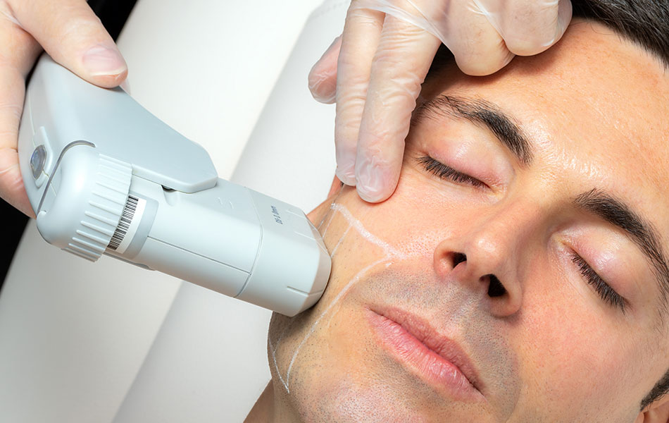 HIFU Offer for Smooth, Youthful Skin You’ll Love