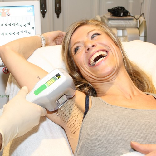 Miradry Treatment: Confidence in Every Situation