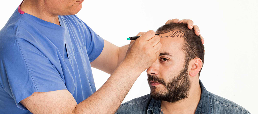 The Art of Forehead Reduction Surgery Unveiled