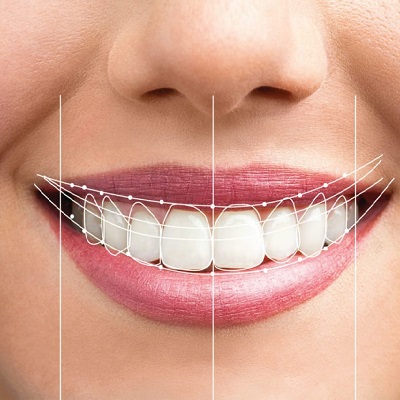 Exploring the Link Between Oral Health and Digital Smile Design Outcomes