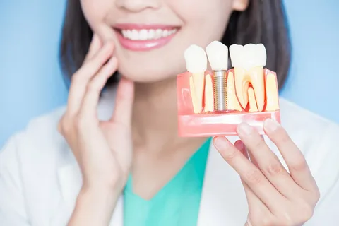 Achieve a Natural-Looking Smile with Dental Implants in Islamabad