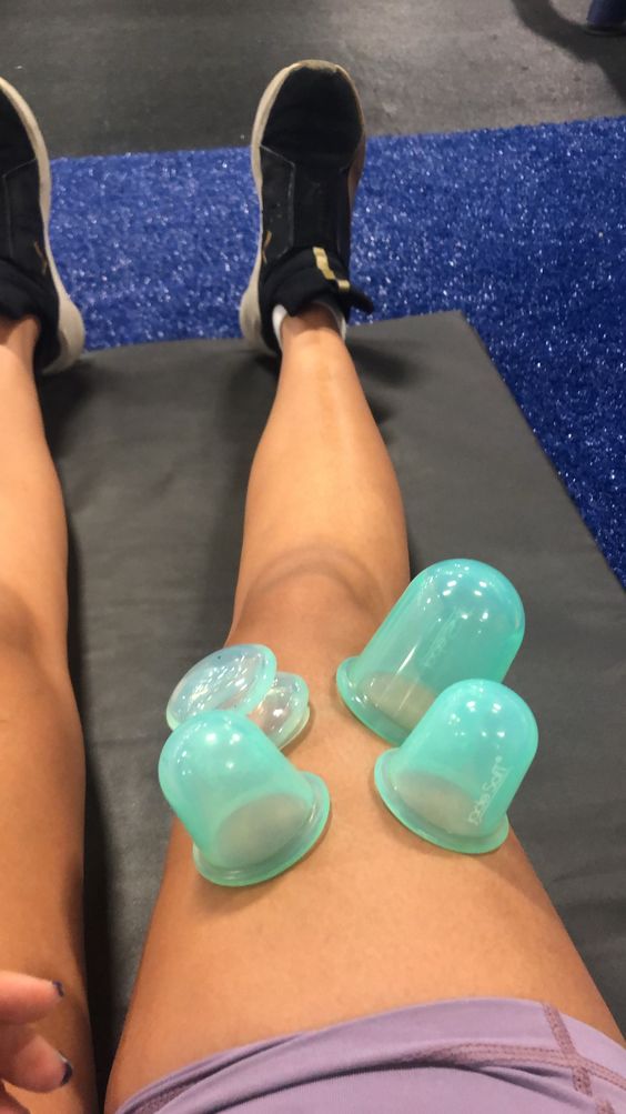 Hijama Therapy: Boost Immunity and Vitality