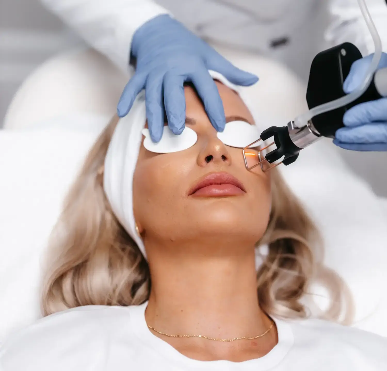 How to Prepare for the Costs of Fractional CO2 Laser Treatments