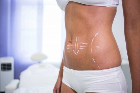 J-Plasma Skin Tightening: A Game-Changer for Thigh and Arm Lifts