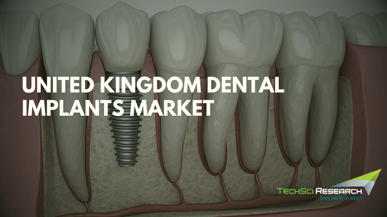 United Kingdom Dental Implants Market: Size, Share, and In-Depth Competitive Analysis Toward 2029