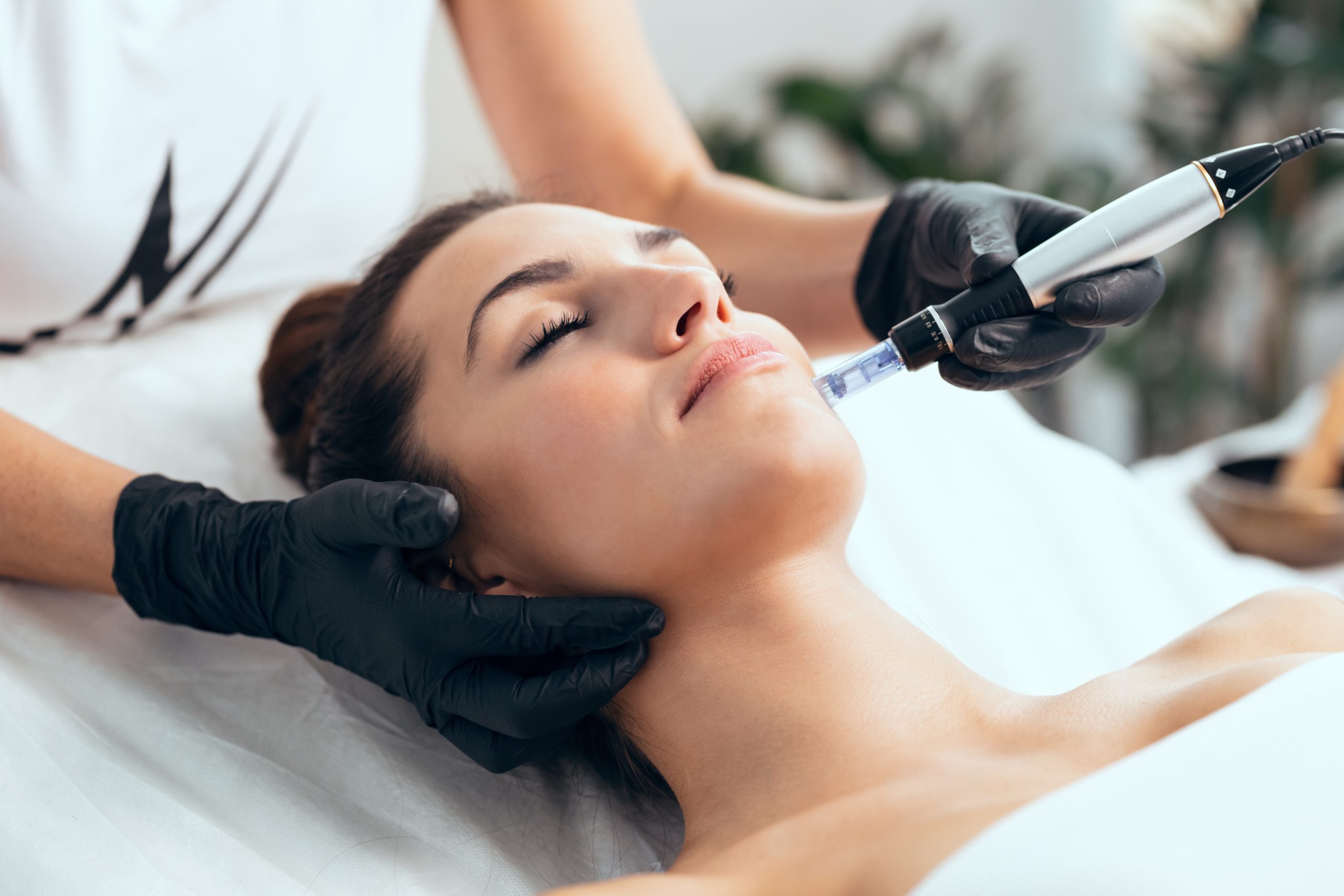 Skin Transformation Made Easy: Try Microneedling for Lasting Results