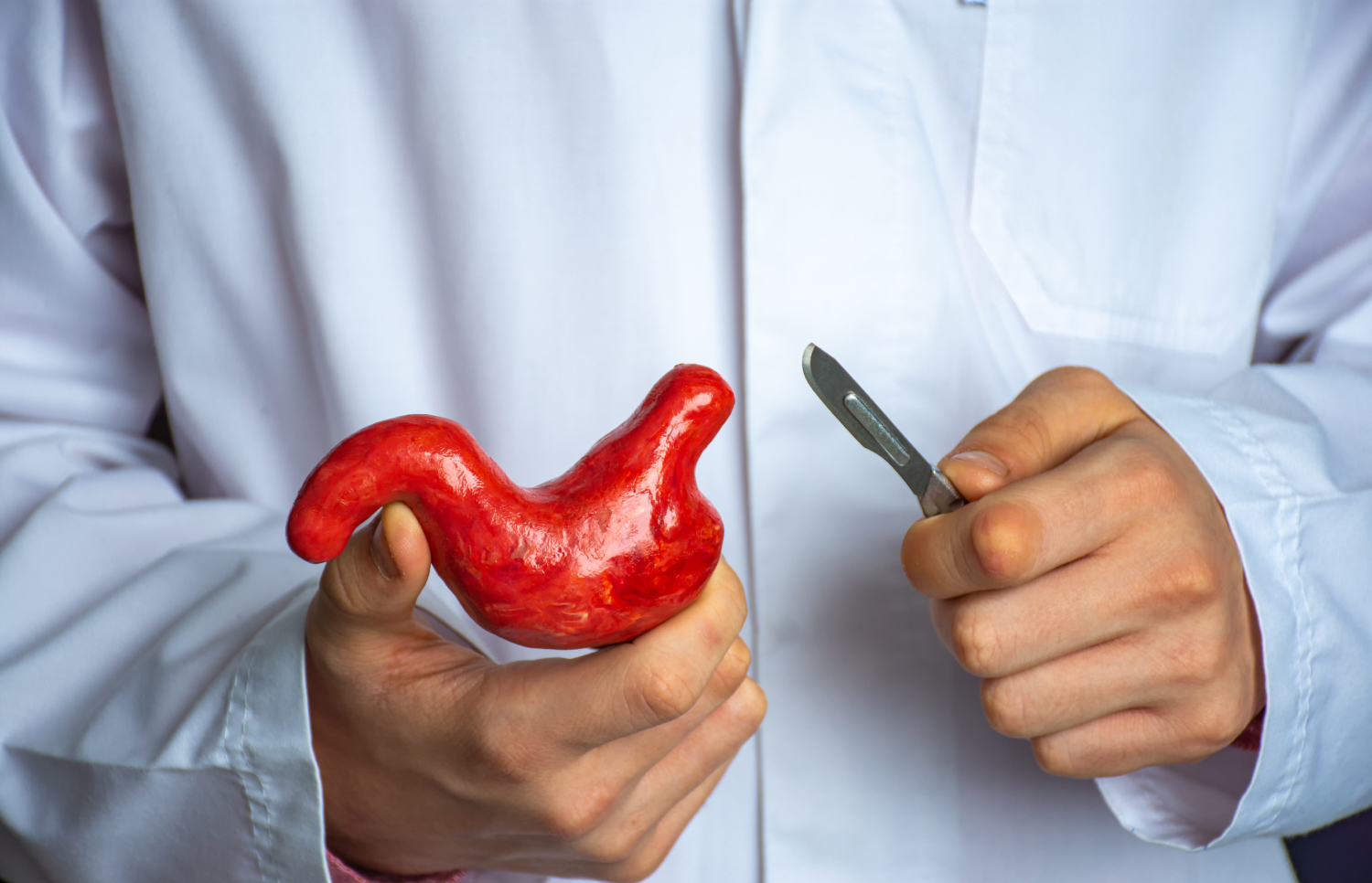 How to Choose the Best Bariatric Surgeon in Islamabad