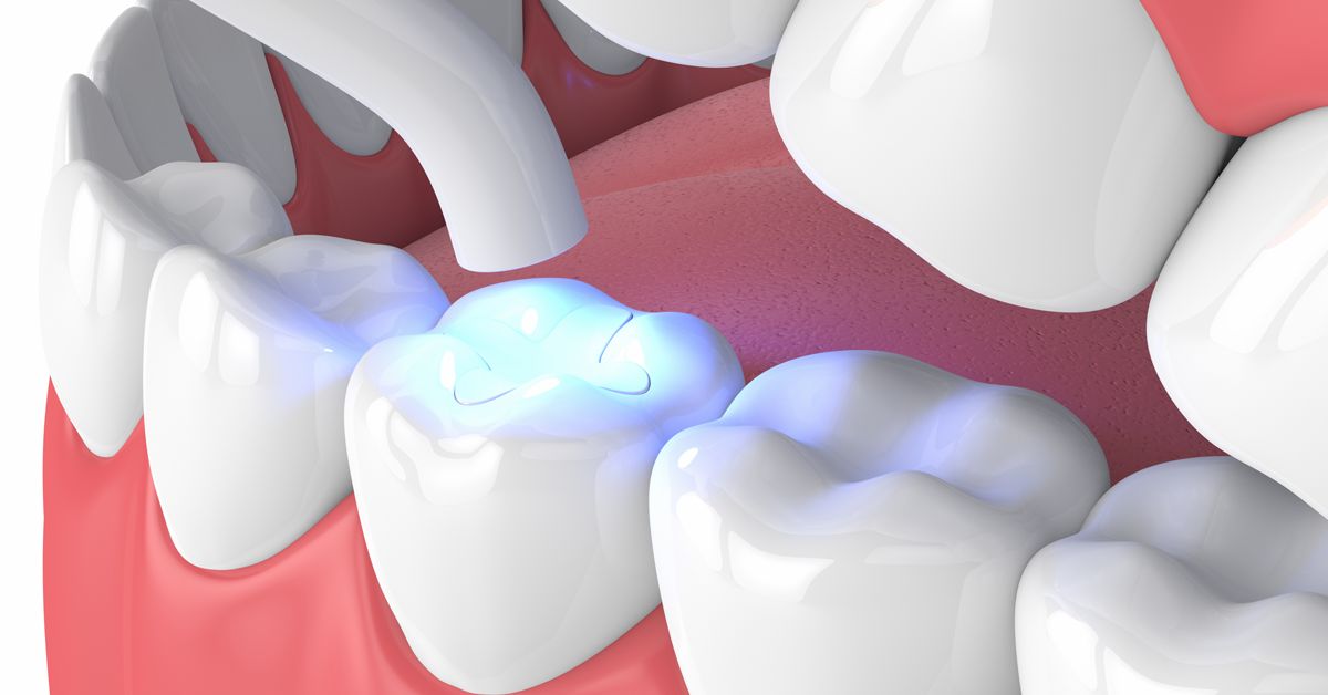 What are the disadvantages of tooth filling?