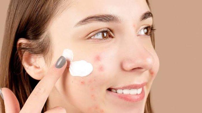 What Are the Different Types of Acne?
