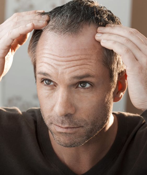 The Future of Hair Replacement: Trends to Watch