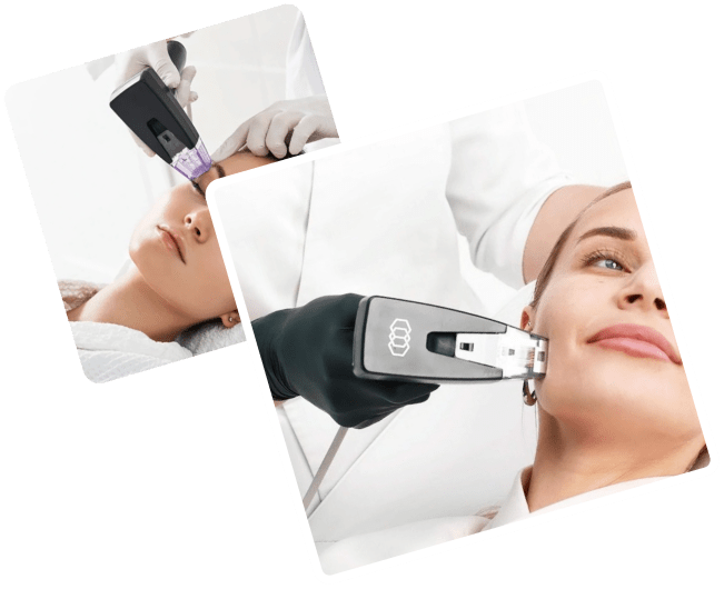 Morpheus8: The Ultimate Solution for Wrinkle Reduction