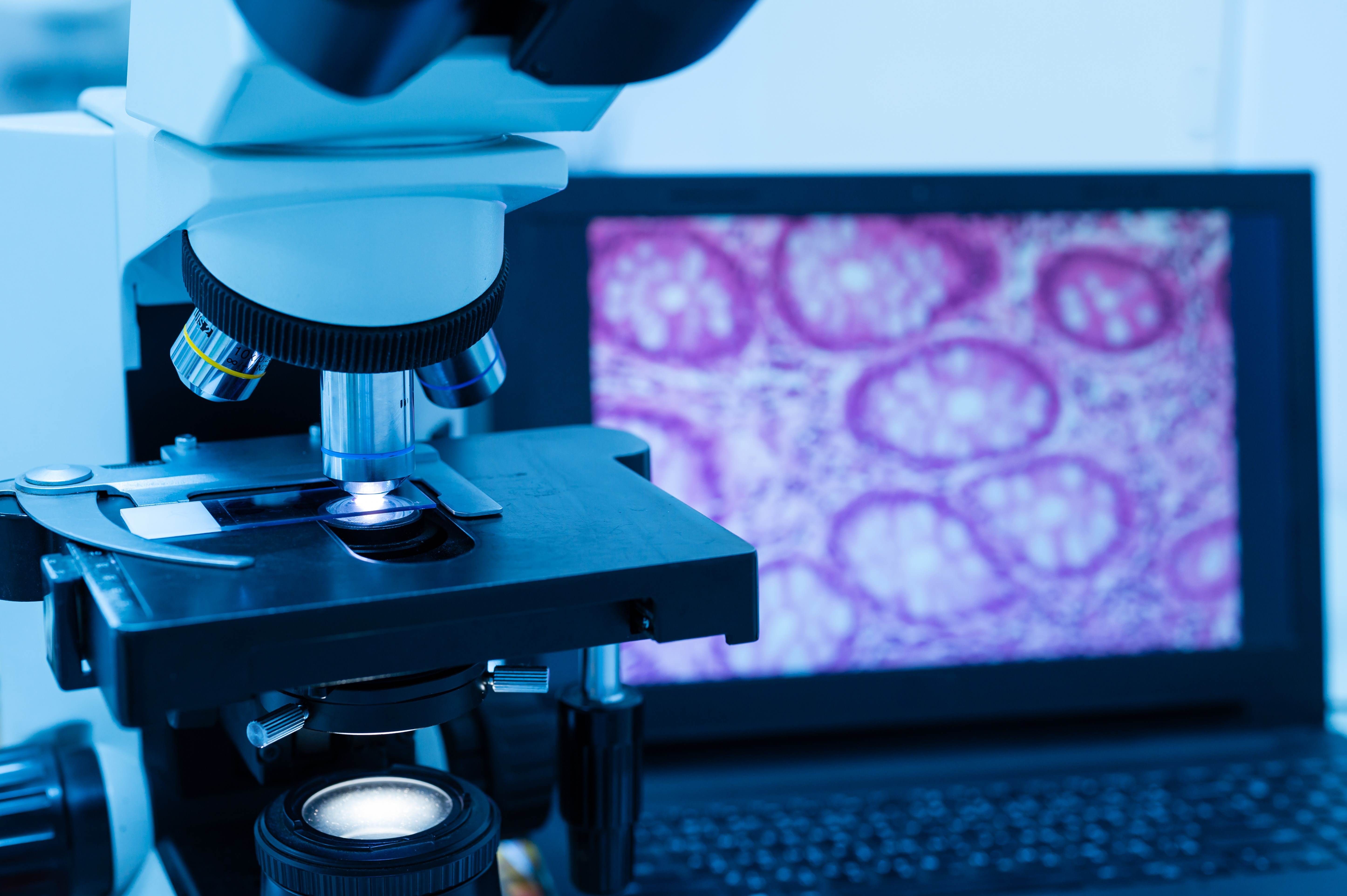 Whole Slide Imaging Market Size, Share Report, Trends and Future Outlook by 2032