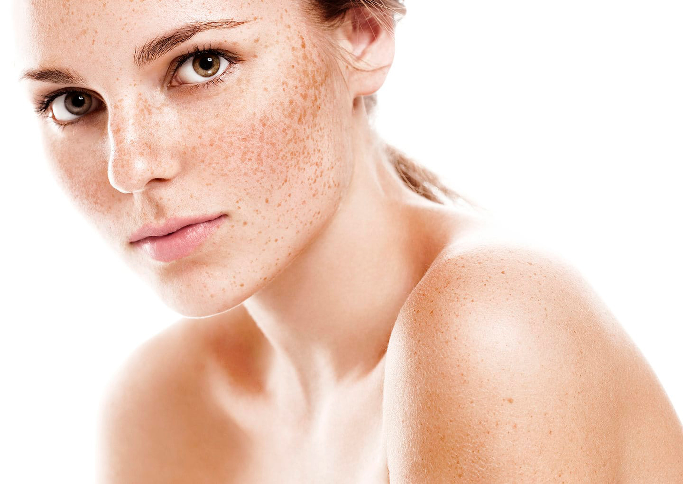 Laser Treatments for Melasma in Islamabad: Everything You Need to Know