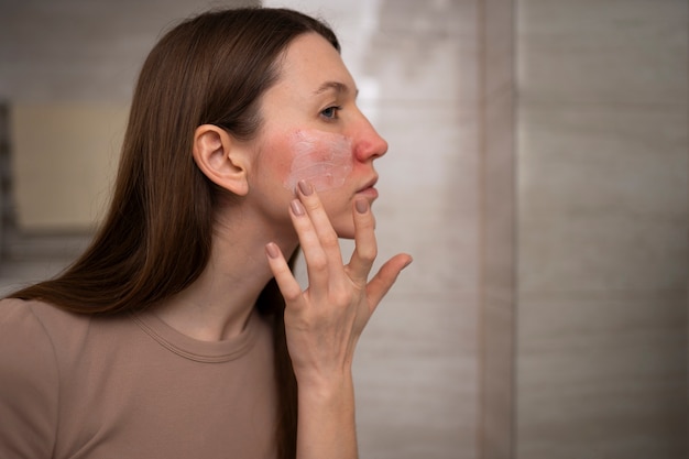 How Rosacea Treatment Affects Overall Health