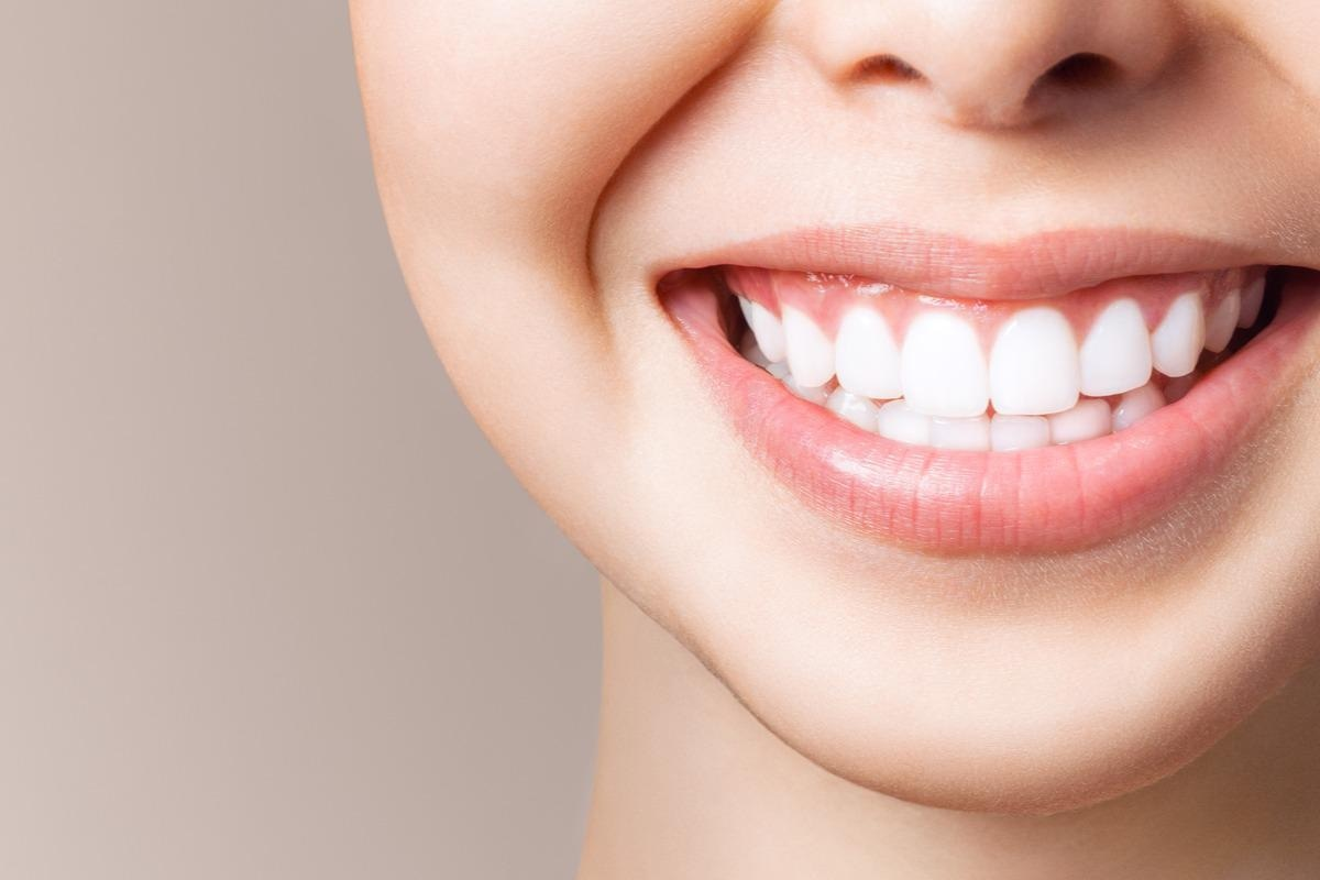 Top Teeth Whitening Options: What You Need to Know