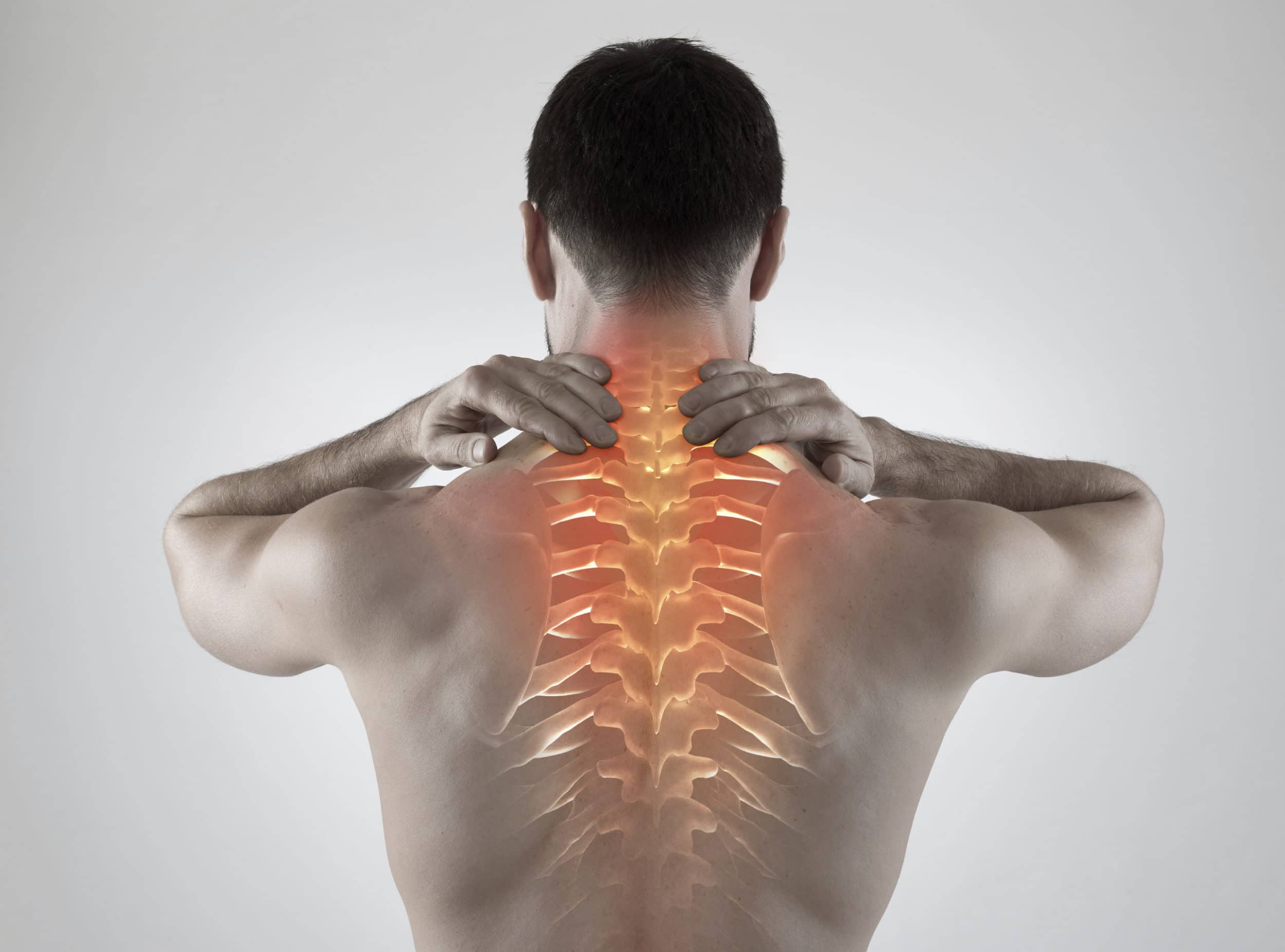 How Can Posterior Cervical Fusion Help You Recover from Spinal Injuries?