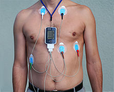 Ambulatory Cardiac Monitoring Market: Size, Share, CAGR, Trends, Growth, Analysis, Statistics & Forecast