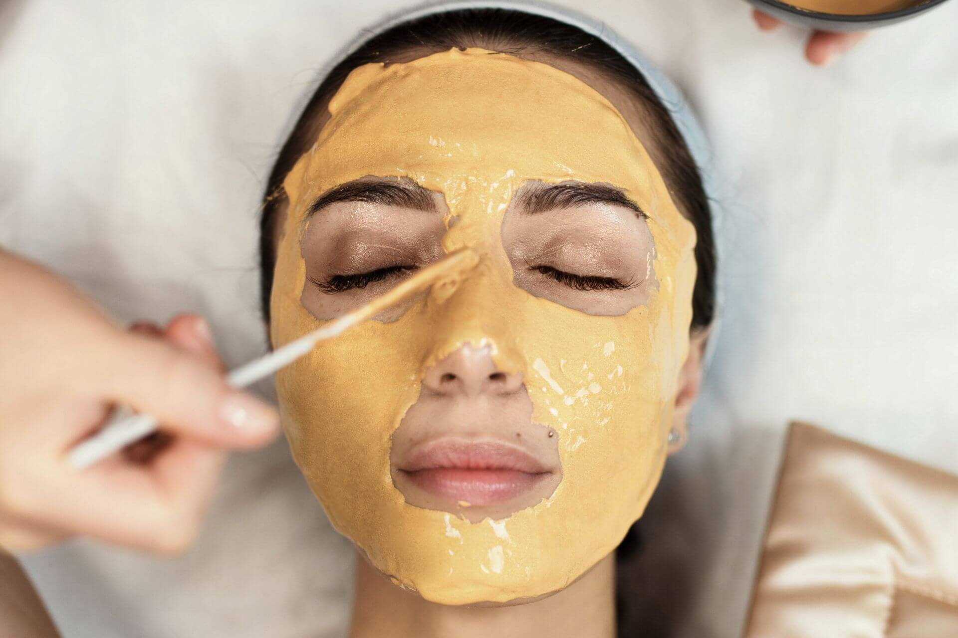 Do chemical peels work permanently?
