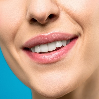 Whitening Your Teeth Before a Big Event: Timing and Tips