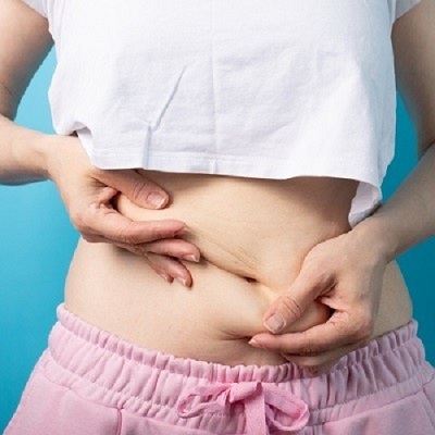 Customized Liposuction Treatments Available in Islamabad