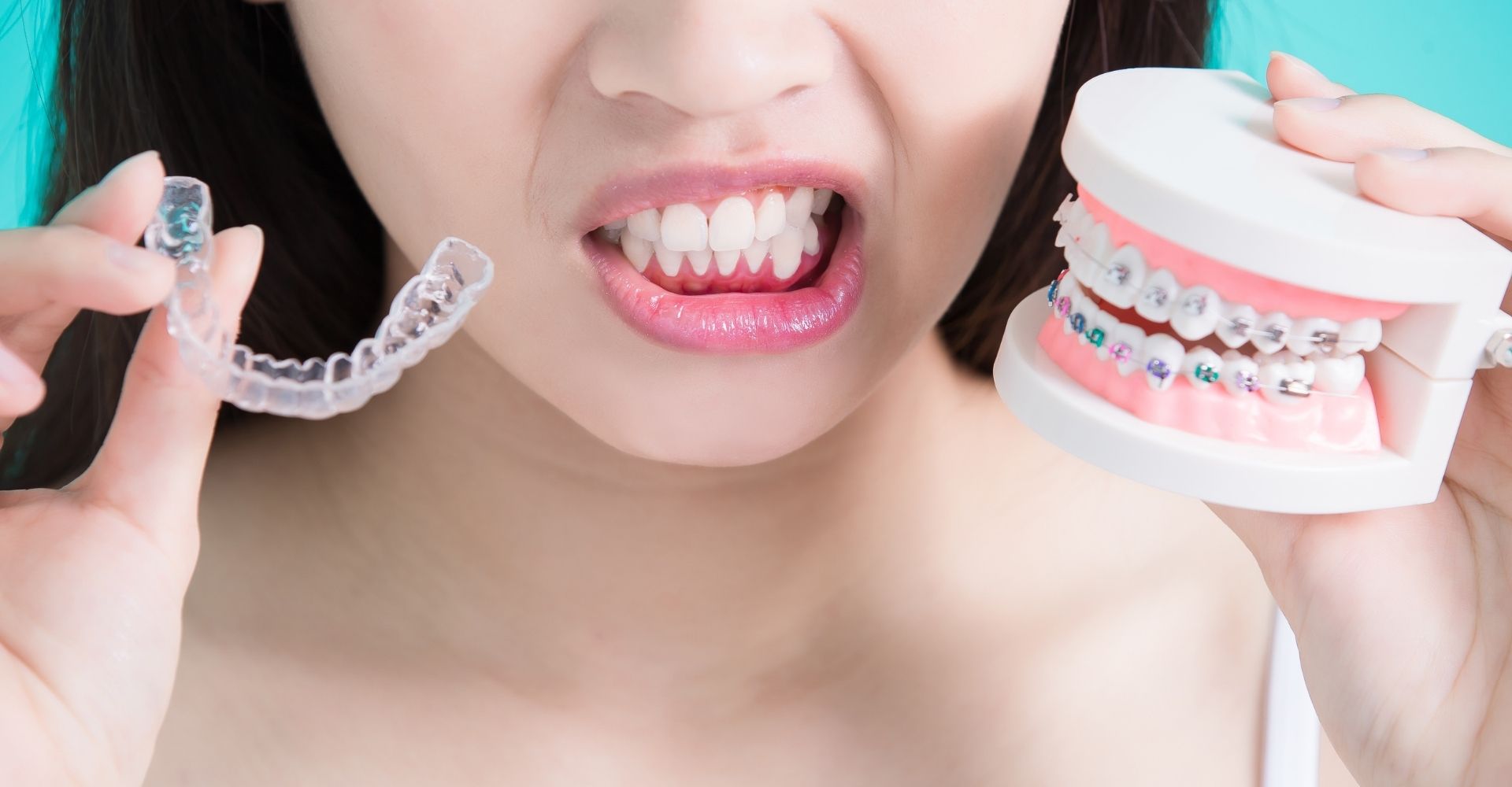 Aligners: A Convenient Solution for Busy Lifestyles