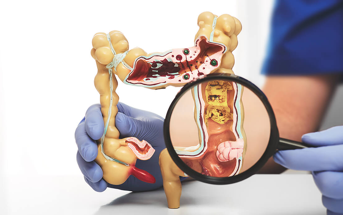 Colorectal Surgery Market: Unlocking Growth Secrets, Trends and Developments [2029]