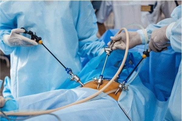 Endoscopy Operative Devices Market 2029: Untapped Opportunities and Growth Strategies Revealed