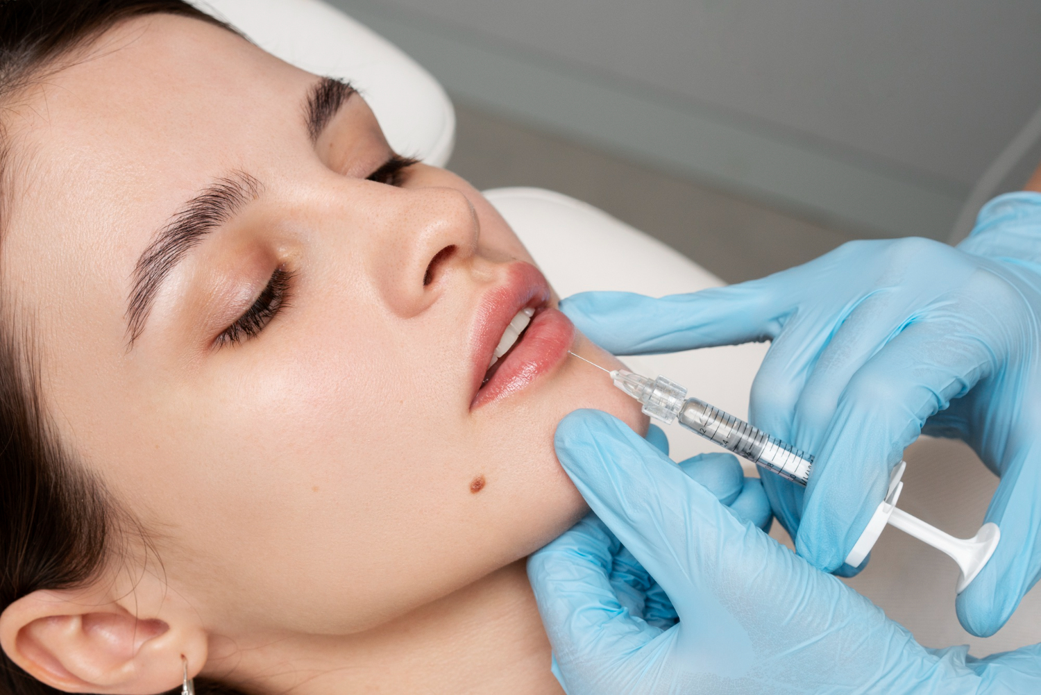 How Dermal Filler for Jowls Can Help Reduce Jowls