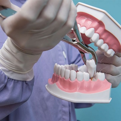 How Tooth Extractions Affect Your Bite and How to Fix It