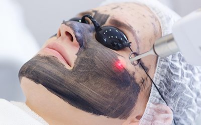 Carbon Laser Peel or Microdermabrasion Which Should You Choose
