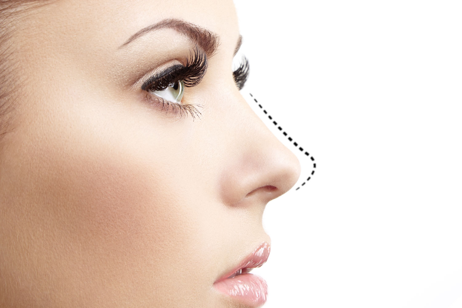 The Benefits of Rhinoplasty in Dubai