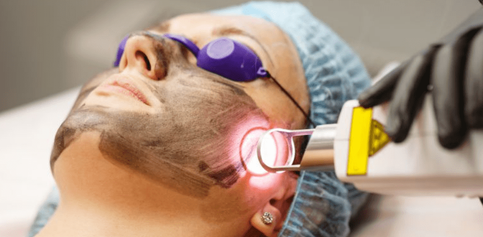 Transform Your Skin The Process of Laser Facial Treatments in Dubai Explained
