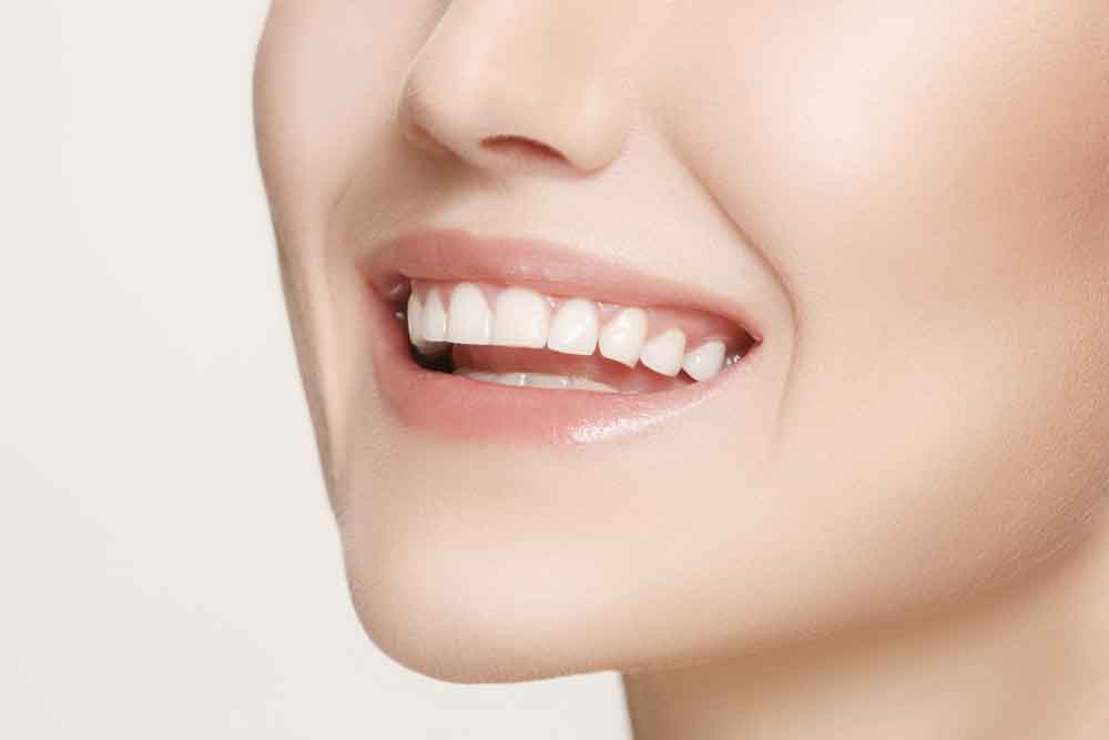 Teeth Whitening in Dubai: Techniques and Benefits Explained