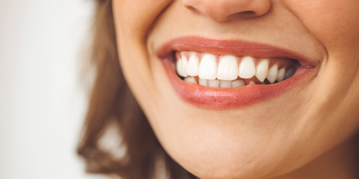Timeless Beauty Begins with a Hollywood Smile Makeover