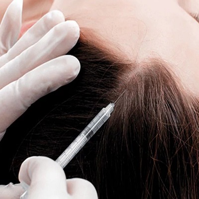 Dubai’s Experts in Exosome-Based Hair Growth