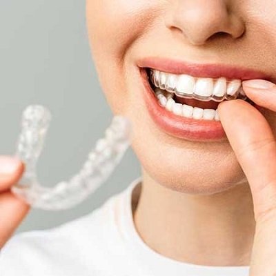 The Psychological Benefits of Fixing Overlapping Teeth in Dubai