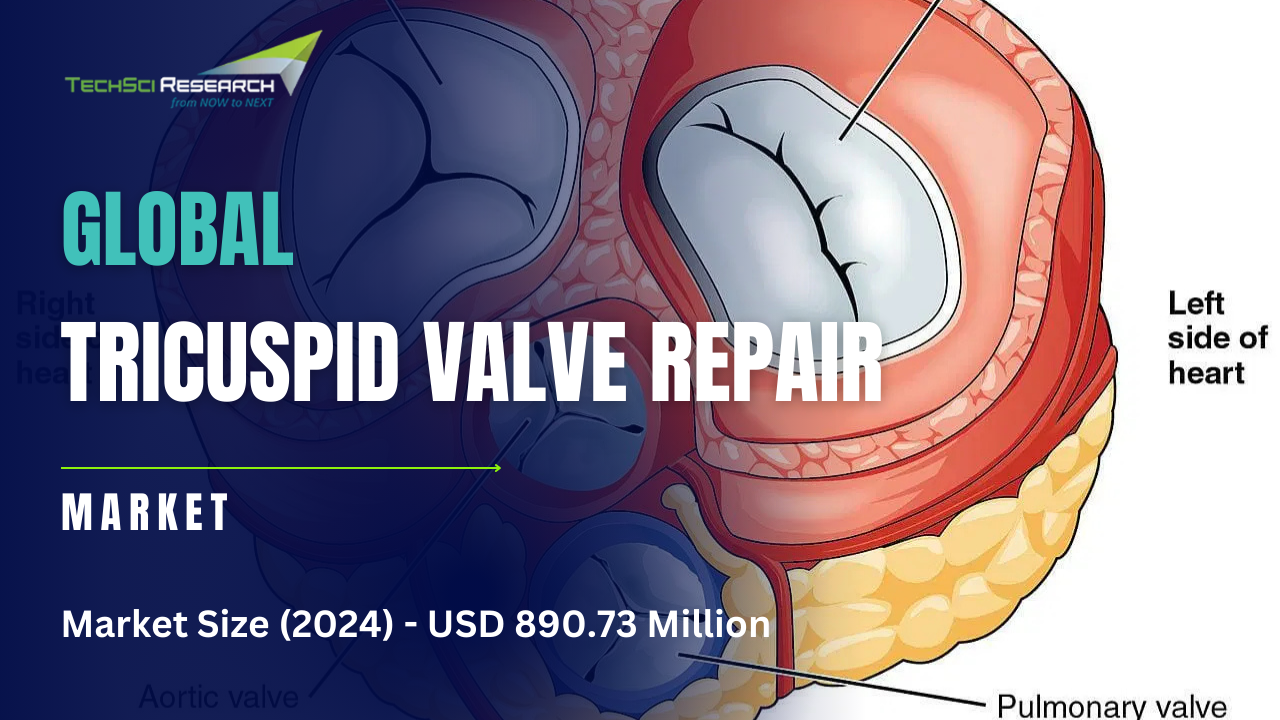 Tricuspid Valve Repair Market 2029: Untapped Opportunities and Growth Strategies Revealed