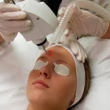 Laser Vein Treatment in Dubai Safe Solutions for Spider and Varicose Veins